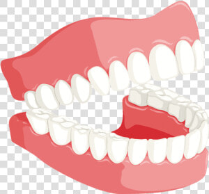 Smiling Denture   Tongue Position Front  HD Png Download