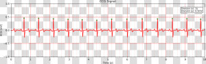             Images ecg10   Python Ecg Data Report  HD Png Download