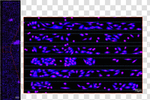 Figure 2b   Slide Of A Human Cell That Has Been Fluorescence Stained  HD Png Download