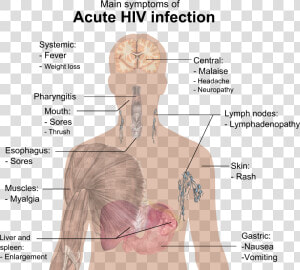 Symptoms Of Acute Hiv Infection   Hiv Symptoms  HD Png Download