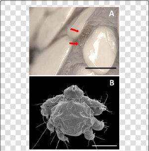 Computed Tomography  HD Png Download