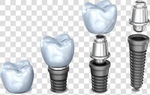 Implant Pieces Dental Implant Dentist Northborough   Implante Dental De Titanio  HD Png Download