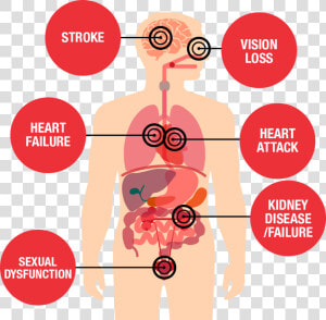 Health Threats Diagram   Effects Of High Blood Pressure  HD Png Download