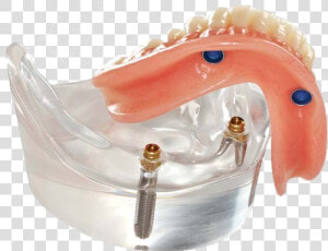 Stabilize Your Dentures And Regain Bite Strength  HD Png Download