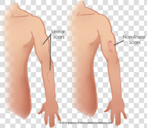 Linear Scars  HD Png Download