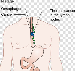 Transparent Esophagus Png   Cartoon  Png Download