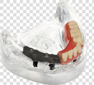 Supra Solution Bar Denture Photo   Tongue  HD Png Download