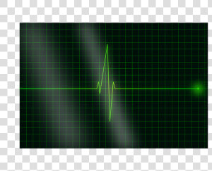 Heartbeat  Pulse  Heart  Signal  Ekg  Electrocardiogram   Laser  HD Png Download