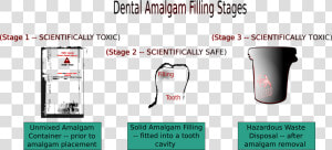 Dental Amalgam Filling Stages Clip Arts  HD Png Download