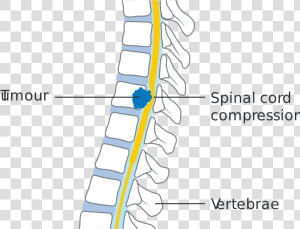 Medullary Compression  HD Png Download