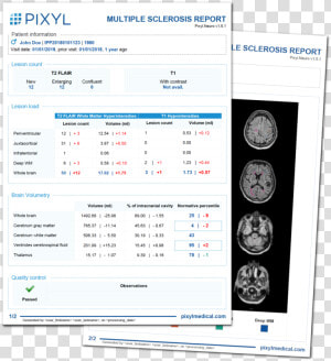 Reports Of Multiple Sclerosis  HD Png Download