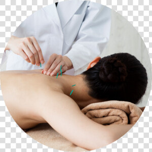 Acupuncture1   Fisioterapia Em Acupuntura  HD Png Download