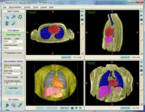 Computed Tomography  HD Png Download