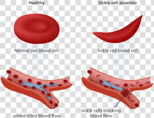 Cotton Clipart White Blood Cell   Red Blood Cell Sickle Cell  HD Png Download