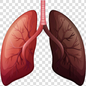 Lungs Png   Lung Cancer Before And After  Transparent Png