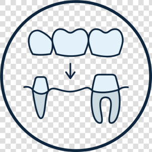 Dental Crown And Bridge Icon   Transparent Cartoons   Dental Crown And Bridge Icon  HD Png Download