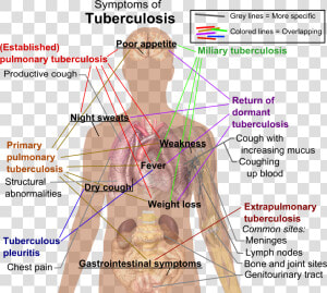 Tuberculosis Symptoms   Symptoms Of Tuberculosis  HD Png Download