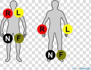 Ecg Limb Leads Colour  HD Png Download