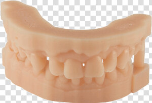 Dental D Material Prodways   3d Printed Dental Model  HD Png Download