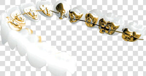 Transparent Gold Teeth Png   Incognito Braces Png  Png Download