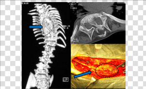 Medical Imaging  HD Png Download