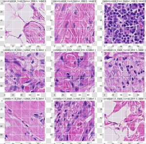 Histopathologic Cancer Detection  HD Png Download