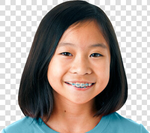 Girl With Braces Png  Transparent Png