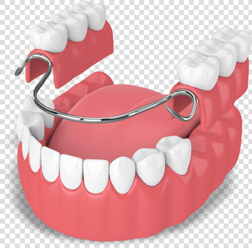 Que Es Una Protesis Dental  HD Png DownloadTransparent PNG