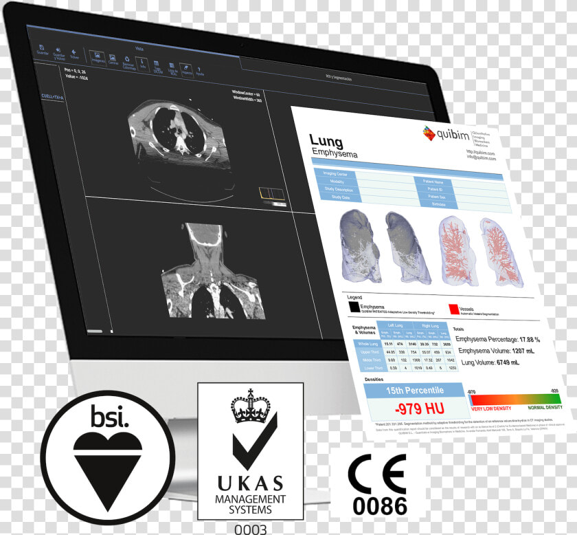 Quibim Ce Mark   Ukas Quality Management  HD Png DownloadTransparent PNG