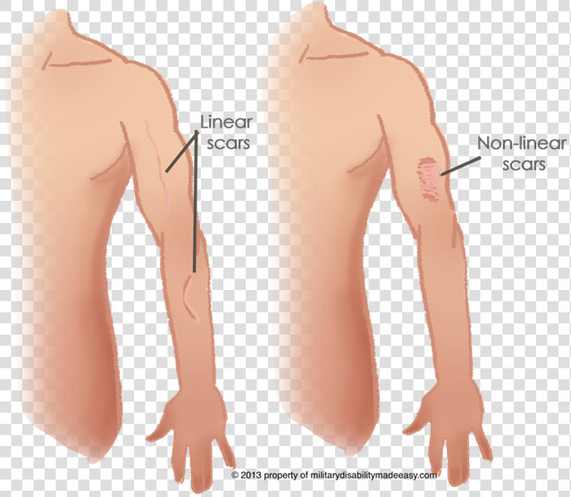 Linear Scars  HD Png DownloadTransparent PNG