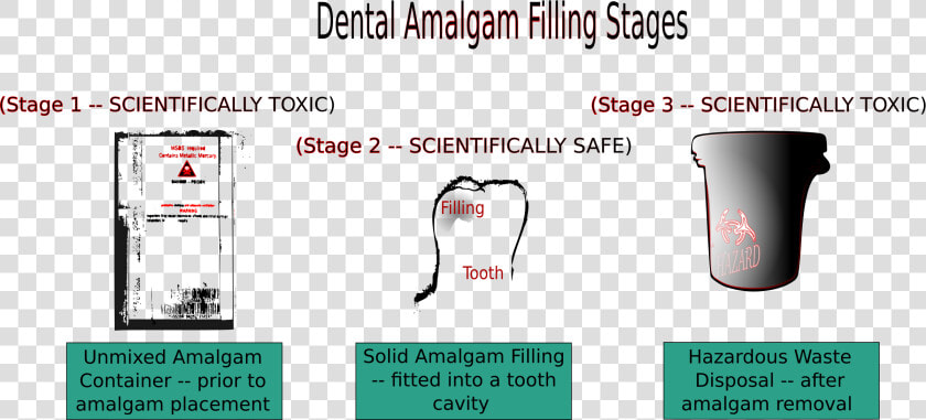 Dental Amalgam Filling Stages Clip Arts  HD Png DownloadTransparent PNG