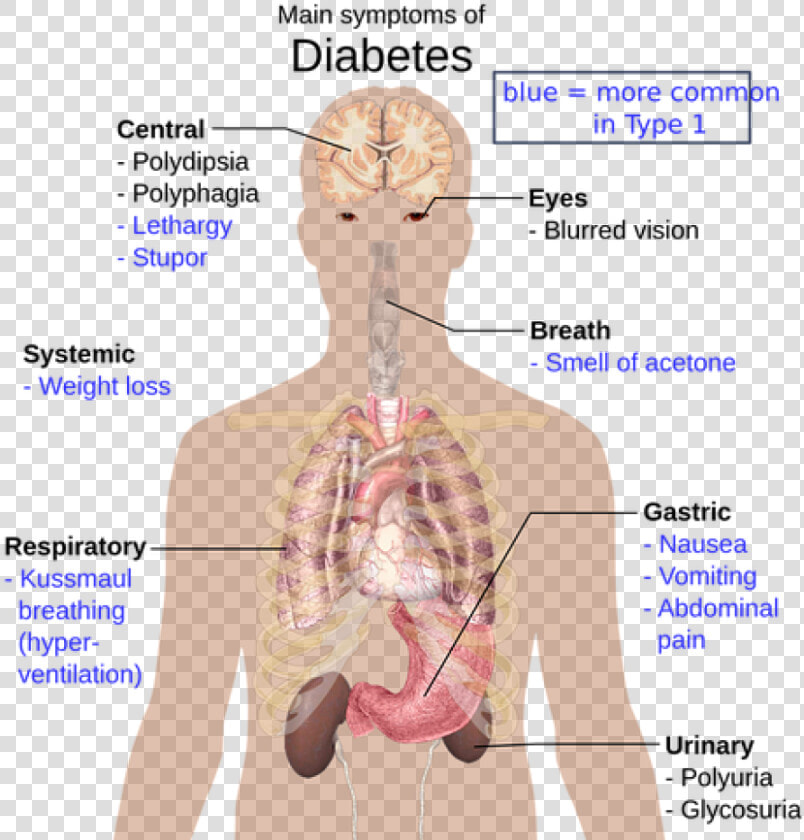 Disease In Organ System  HD Png DownloadTransparent PNG