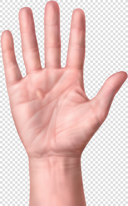 One Hand With Nodules Or Lump In Palm Of Hand   Hand Dupuytren  39 s Contracture  HD Png DownloadTransparent PNG