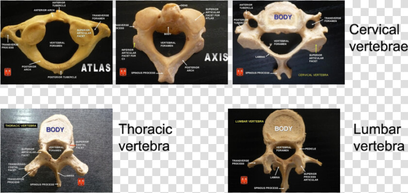 Types Of Vertebrae Anatomy  HD Png DownloadTransparent PNG