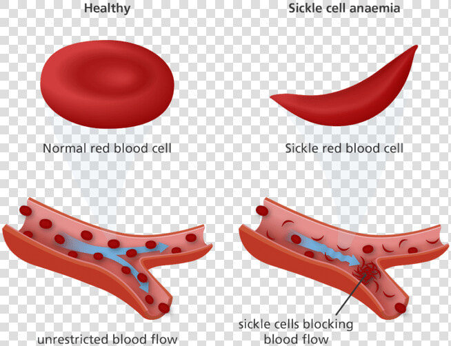 Cotton Clipart White Blood Cell   Red Blood Cell Sickle Cell  HD Png DownloadTransparent PNG