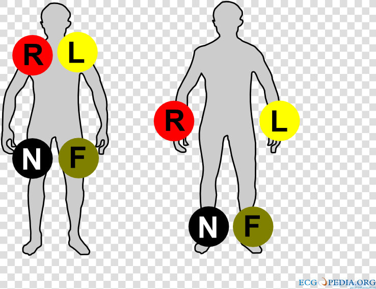 Ecg Limb Leads Colour  HD Png DownloadTransparent PNG