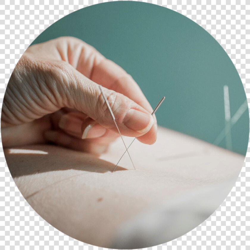 Acupuncture circle   Circle  HD Png DownloadTransparent PNG