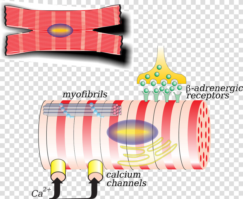 Cardiac Remodelling In Heart Failure  HD Png DownloadTransparent PNG