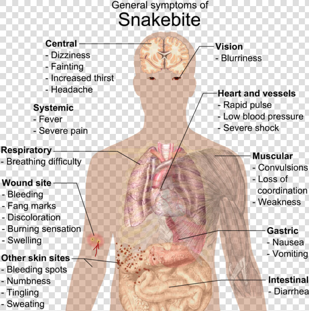 General Symptoms Of Snakebite  HD Png DownloadTransparent PNG