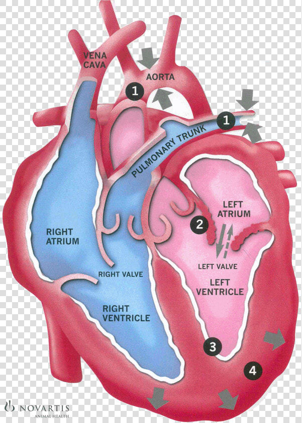 Clip Art Congestive Heart Failure Picture   Heart Failure Back Flow  HD Png DownloadTransparent PNG