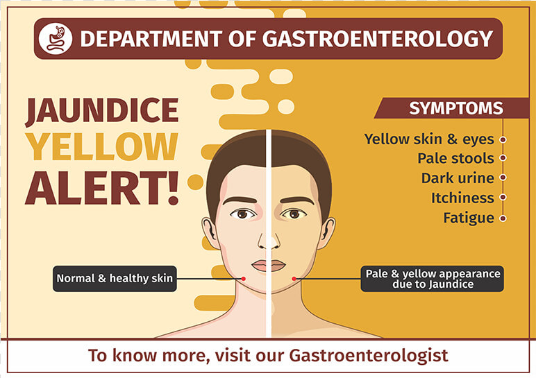 Gastroenterology Jaundice   Poster  HD Png DownloadTransparent PNG