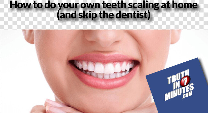 Teeth Scaling Side Effects   Photo Caption  HD Png DownloadTransparent PNG