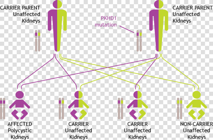 How Arpkd Is Inherited   Adpkd Genetics  HD Png DownloadTransparent PNG