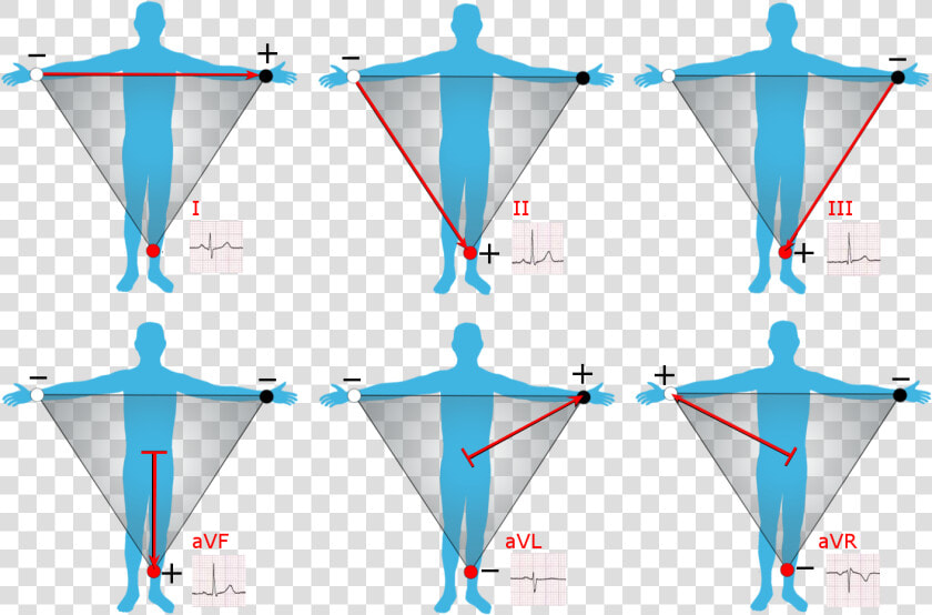 Ecg Limb Leads  HD Png DownloadTransparent PNG